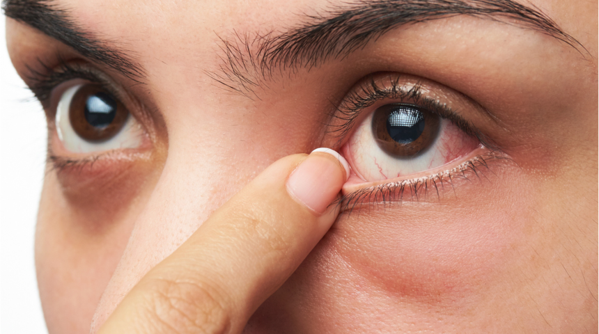 Yorgun görünen bakışlara dikkat 