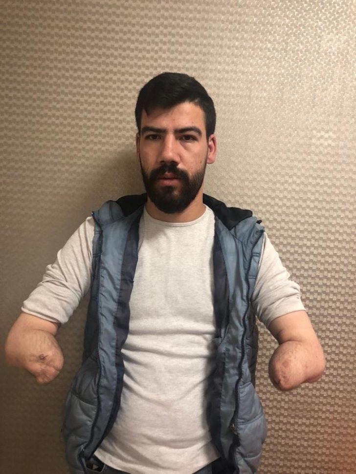 4’üncü çift kol nakli uyandı, sağlık durumu iyi G5