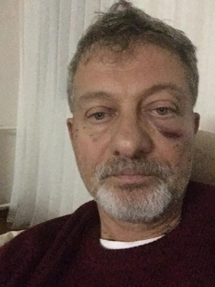 Sağlık raporu vermeyen doktora kafa attı G4