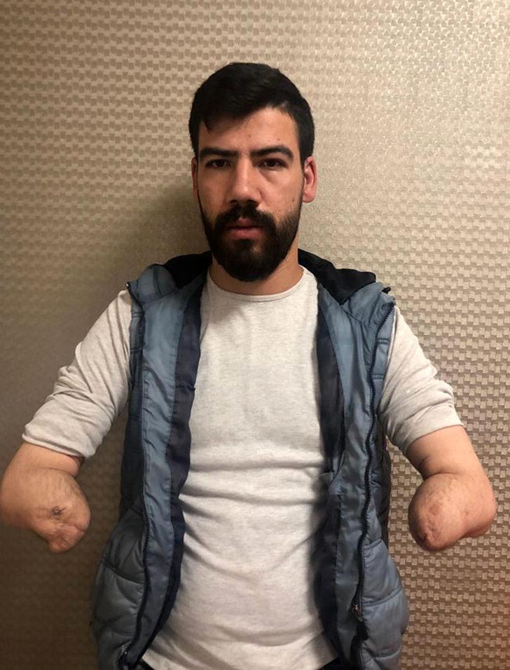 Türkiye'nin 4'üncü çift kol nakli operasyonunda buruk sevinç G5