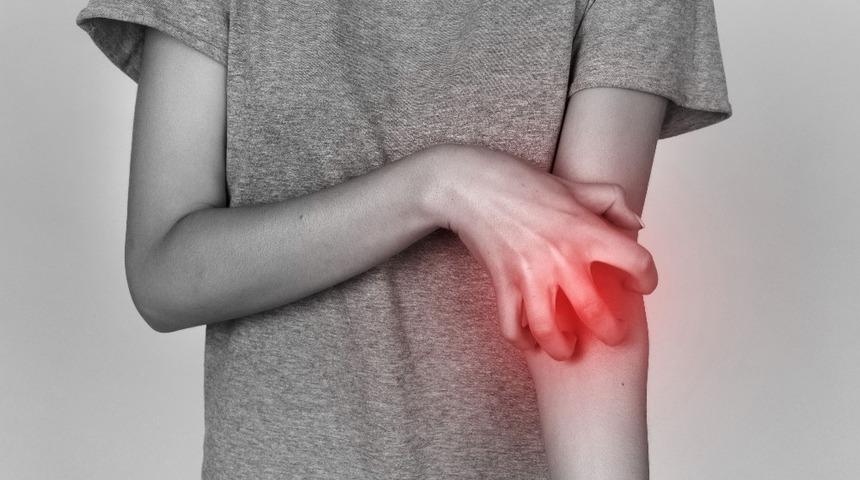 Uyuzda erken tedbir çok önemli