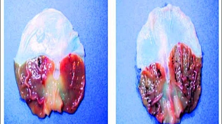 Ruhumuzla bağlantı kurmamızı sağlıyor, beyinde yer alıyor!