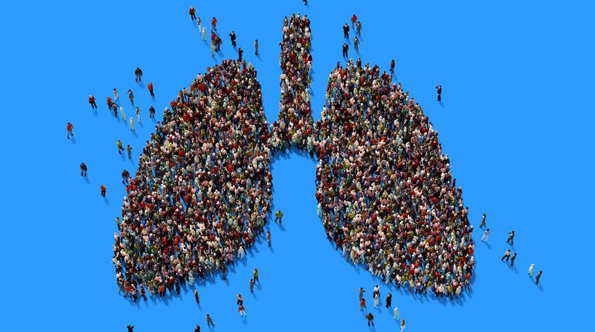 Akciğer kanseri erkeklerde kansere bağlı &ouml;l&uuml;mlerde ilk sırada