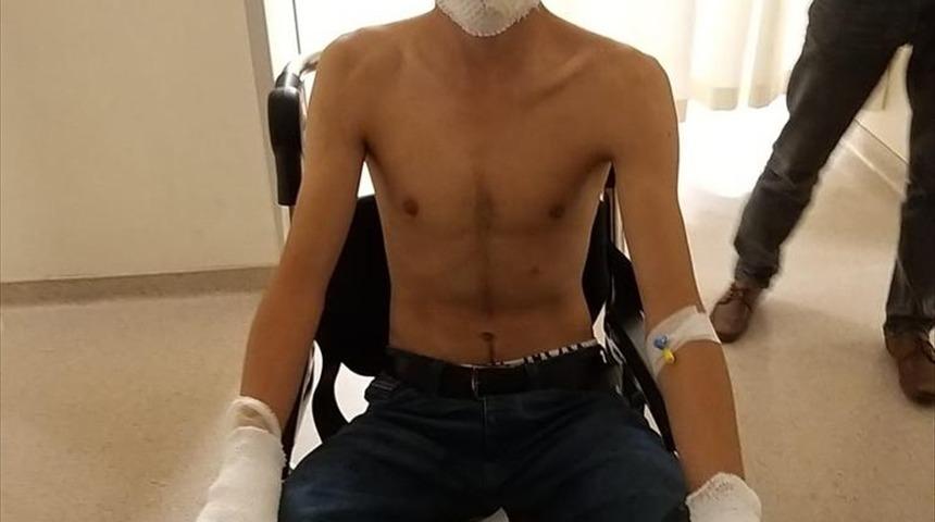 Evi kundaklamaya çalışırken kendilerini yaktılar