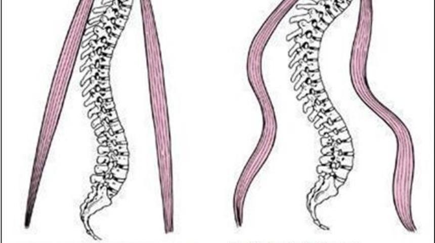 Omurga yetmezliğine dikkat