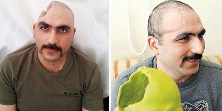 Bu merkezde "insan yedek parçası" üretiliyor G2