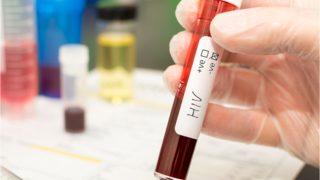 Bu virüs 12 ile 18 ayda öldürüyor 