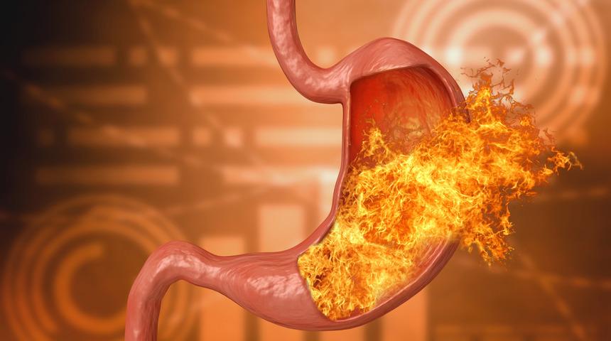 Reflü belirtileri nelerdir? Yemek yerken su içiyorsanız dikkat!