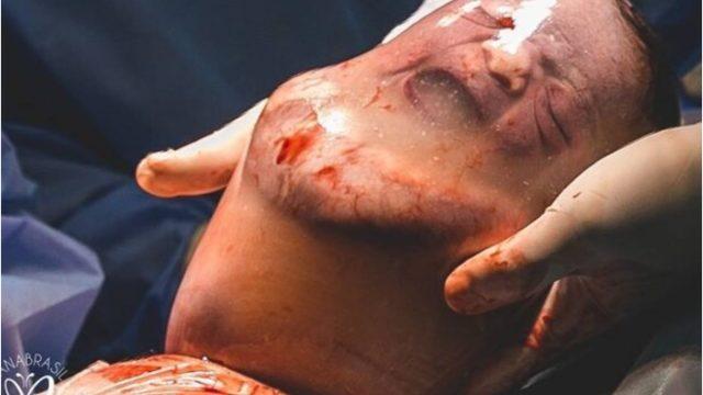 Anne karnındaki hayat suyu amniyon sıvısı ne işe yarıyor?