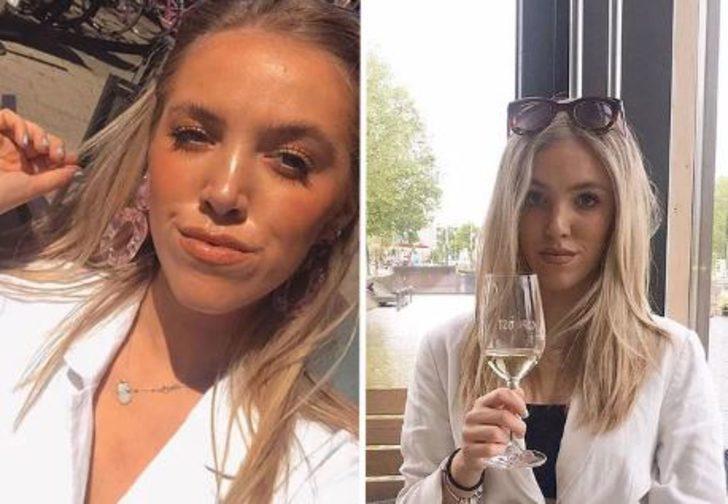 Çenesi yüzünden yıllarca dalga geçtiler! Şimdi ise gören tanıyamıyor G2