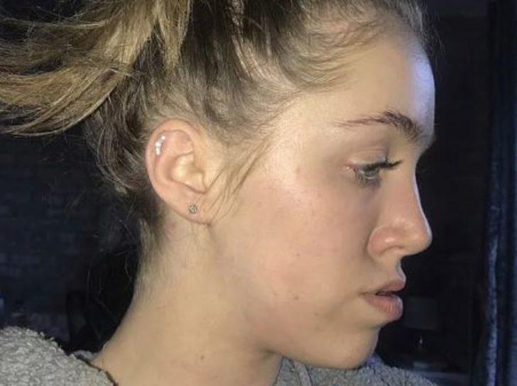 Çenesi yüzünden yıllarca dalga geçtiler! Şimdi ise gören tanıyamıyor G1