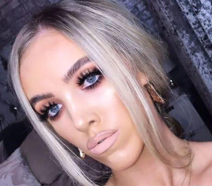 Çenesi yüzünden yıllarca dalga geçtiler! Şimdi ise gören tanıyamıyor G3