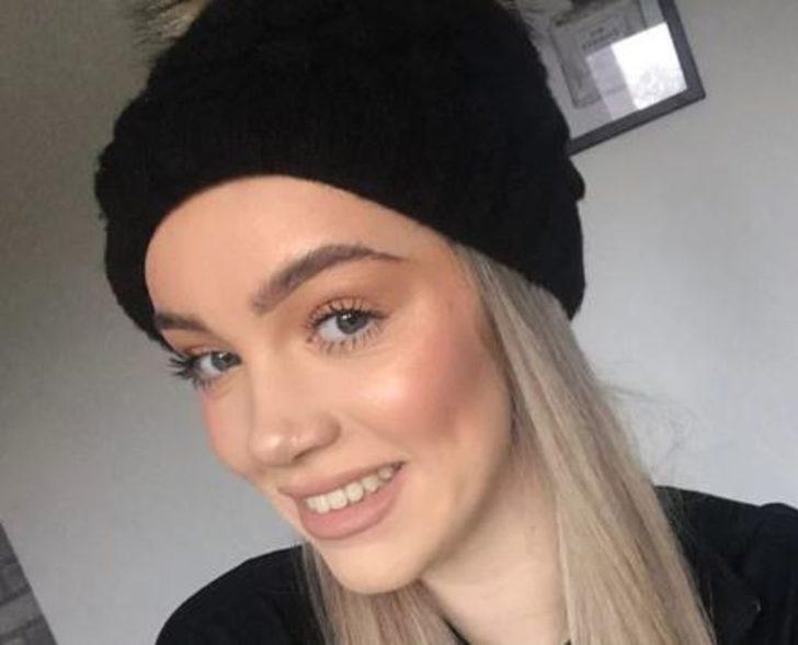 Çenesi yüzünden yıllarca dalga geçtiler! Şimdi ise gören tanıyamıyor G5