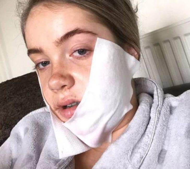 Çenesi yüzünden yıllarca dalga geçtiler! Şimdi ise gören tanıyamıyor G4