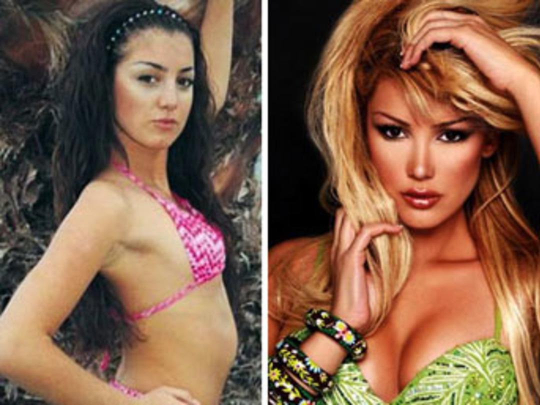 Hangi &uuml;nl&uuml;lerin burunları estetikli?