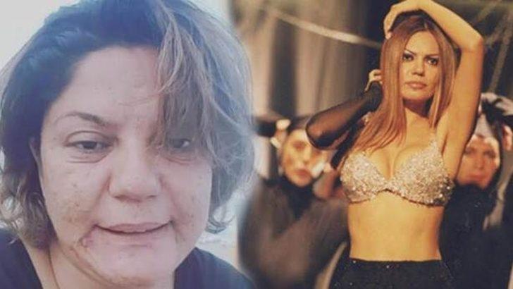 Şarkıcı İzel 15 kilo verdi! Yeni halini görenler inanamadı G4