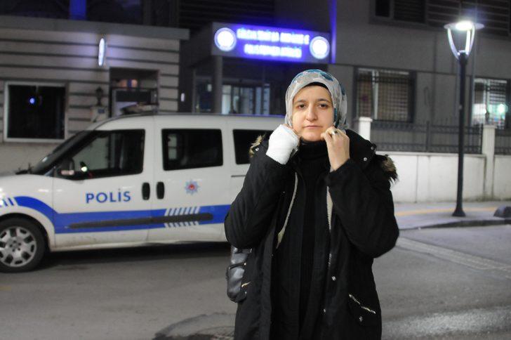 Eşini gelinlikle karşılamıştı! Eline ve alnına sigara bastı G1