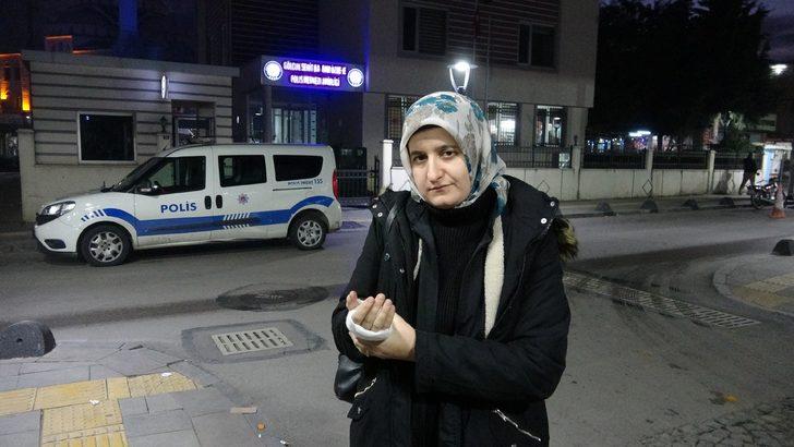 Eşini gelinlikle karşılamıştı! Eline ve alnına sigara bastı G3