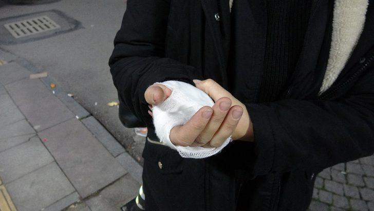 Eşini gelinlikle karşılamıştı! Eline ve alnına sigara bastı G4