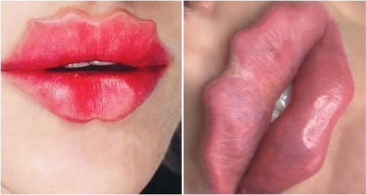 Yeni güzellik trendi şeytan dudaklarına karşı uzmanlar uyarıyor G3