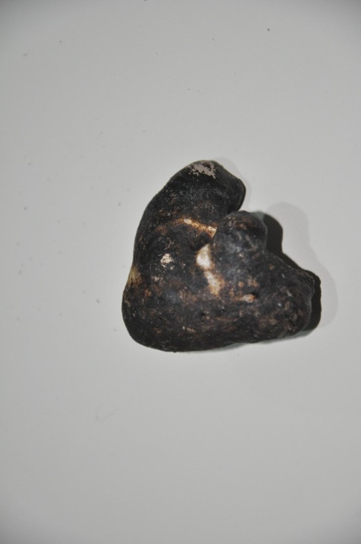 G&ouml;renler inanamadı! Kaya par&ccedil;ası değil b&ouml;brek taşı