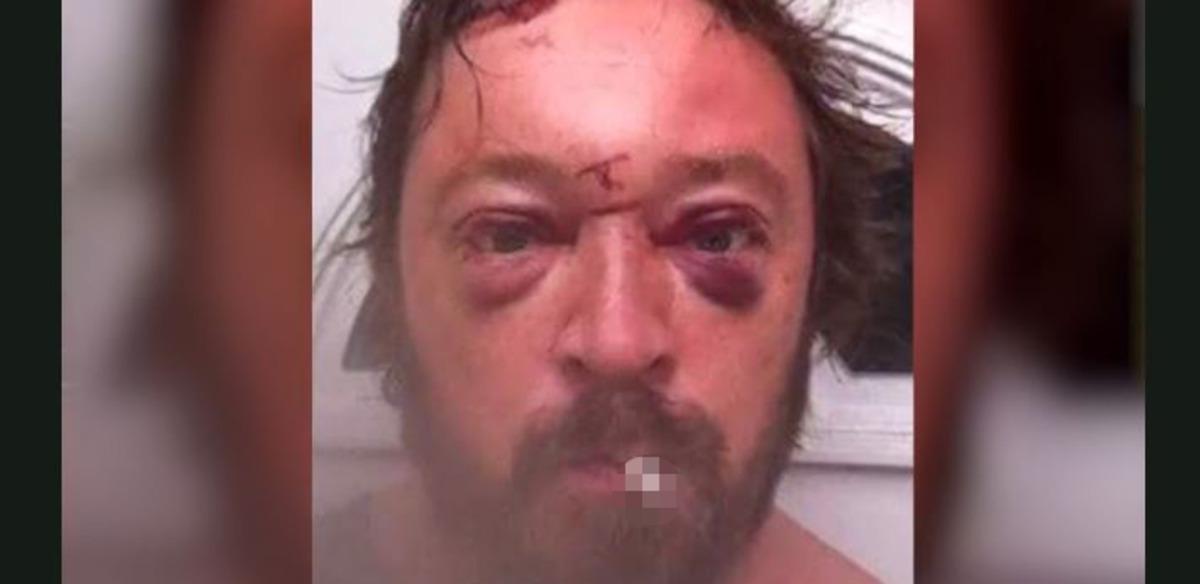 Alkol&uuml; bir fotoğrafla bıraktı! Şimdi bambaşka biri