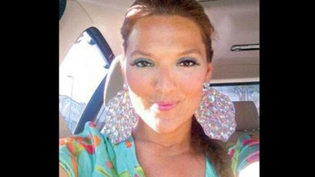 Güzelleşmek isterken yandı