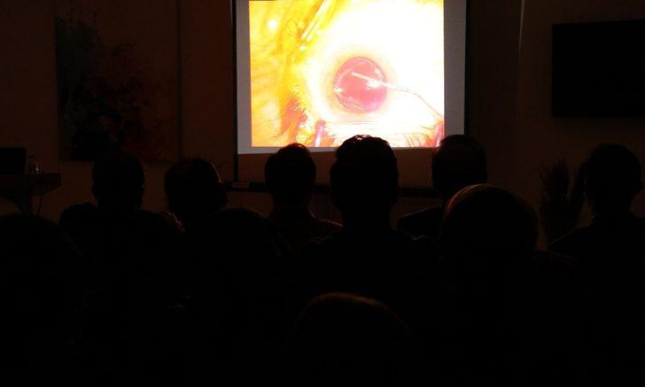 Göz doktorlarına canlı yayında katarakt ameliyatı G1