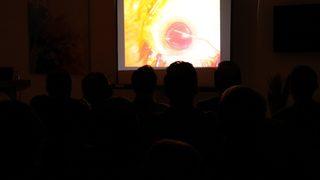 Göz doktorlarına canlı yayında katarakt ameliyatı