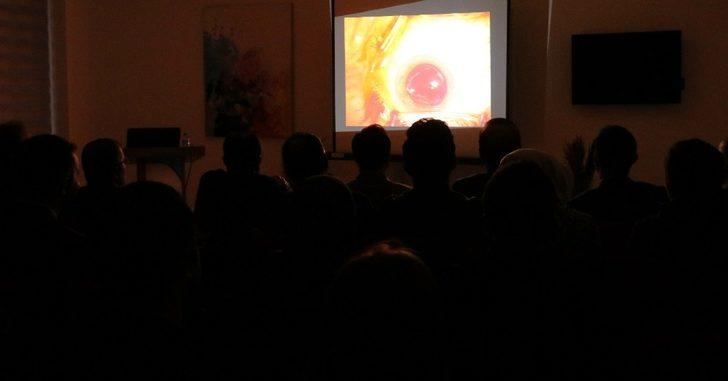 Göz doktorlarına canlı yayında katarakt ameliyatı G4