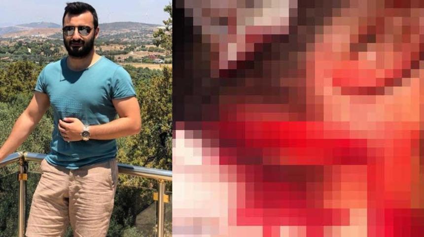 Doktorun boğazını jiletle kesti, ifadesi şoke etti!