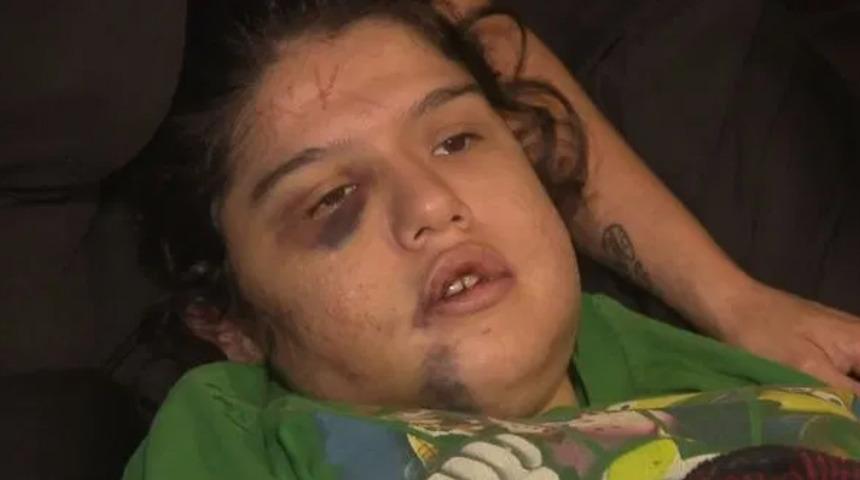 Cani adam, sevgilisinin alnına adını kazıdı!