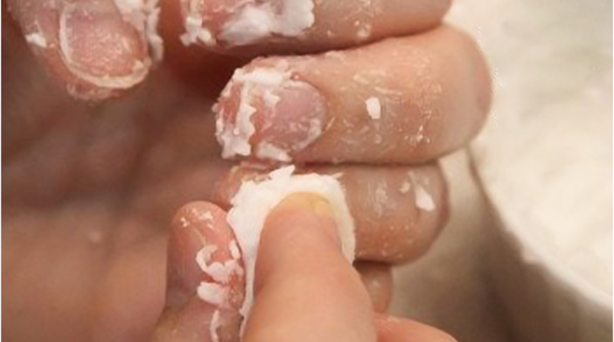  Tırnaklarınızdaki sorunları &ccedil;&ouml;zmenin 6 yolu