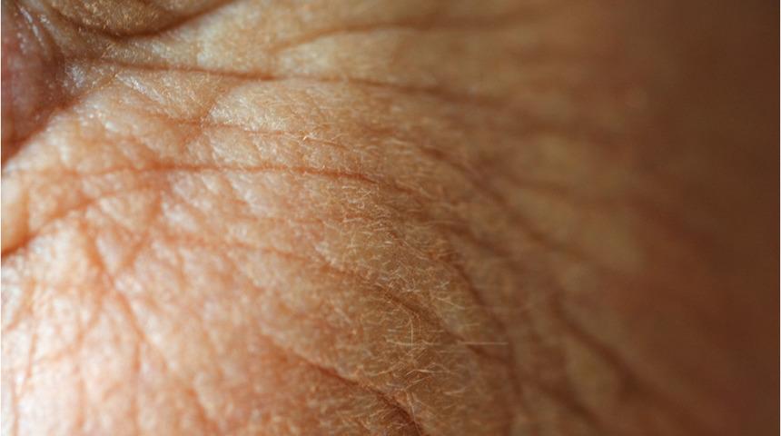 Yaşlanma karşıtı &uuml;r&uuml;nlere başlamak i&ccedil;in en doğru yaş 35