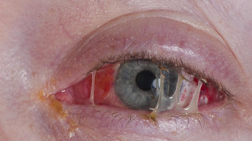 Kirpik diplerinizi yeterince temizliyor musunuz?