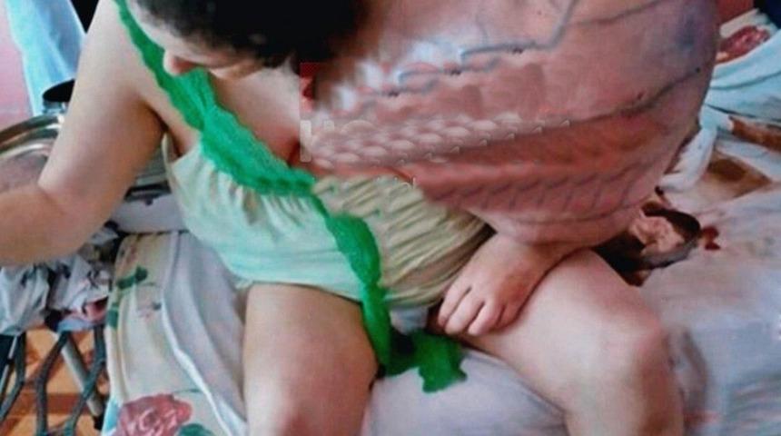 Omzundaki devasa t&uuml;m&ouml;r g&ouml;renleri şoke etti!