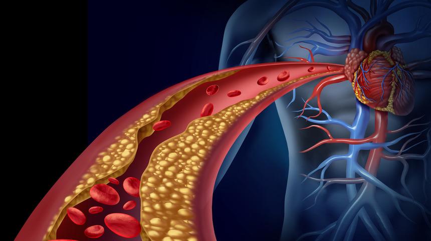 Buerger hastalığı nedir? Buerger tedavisi nasıl olur? Buerger'de uzuv kurtaran yeni tedavi: Hibrit Yöntemler