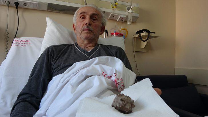 Mesanesinden 130 gramlık taş çıkarıldı; Kendimi hafiflemiş hissediyorum G2