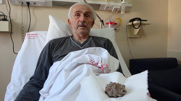 Mesanesinden 130 gramlık taş çıkarıldı; Kendimi hafiflemiş hissediyorum G4