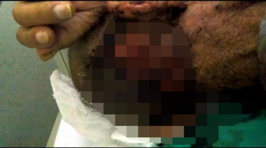 Kafasında kurtçukların türediği görüntü dehşete düşürmüştü! Harekete geçildi