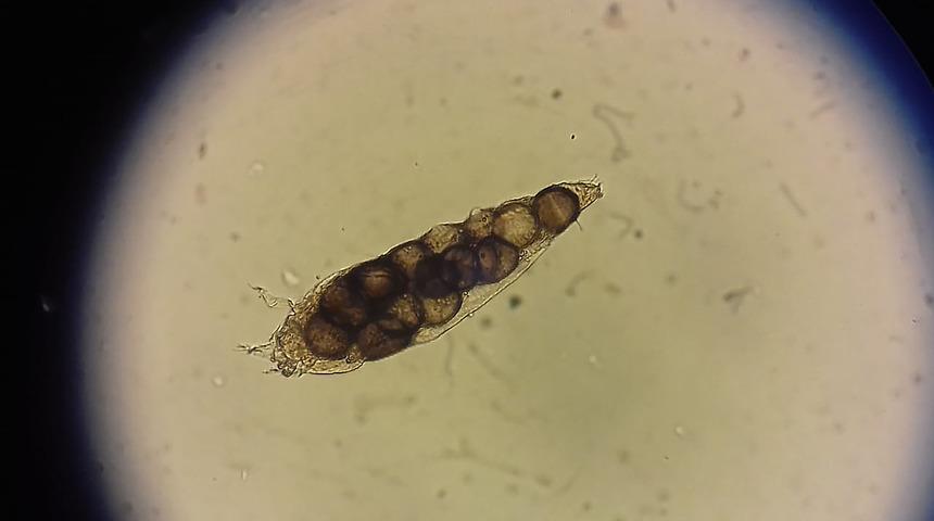 Uyuz salgını iddiaları tedirgin ediyor! (Uyuz hastalığı nedir, belirtileri nelerdir?)