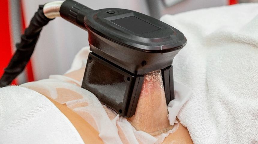 Soğuk lipoliz ile bölgesel incelme