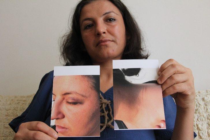 Rehin aldığı eşinin kafasını defalarca demire vurmuş G2