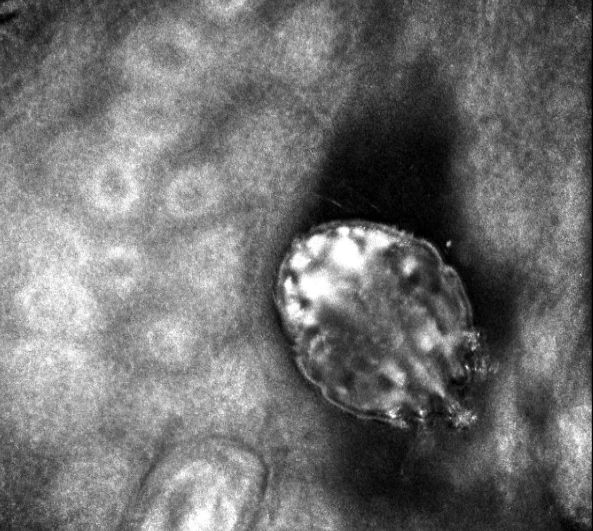 İla&ccedil; firmaları uyuz hastalığında yoğun talebe hazırlıksız yakalandı