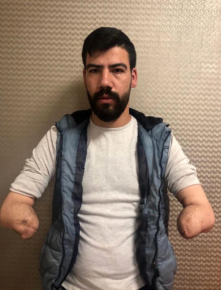 Türkiye'nin 4'üncü çift kol nakillisi Yusuf'un parmaklarında dolaşım başladı G4