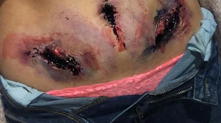 Acı gerçek! Endometriozis ağrısı görünür olsaydı nasıl olurdu?