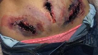 Acı gerçek! Endometriozis ağrısı görünür olsaydı nasıl olurdu?