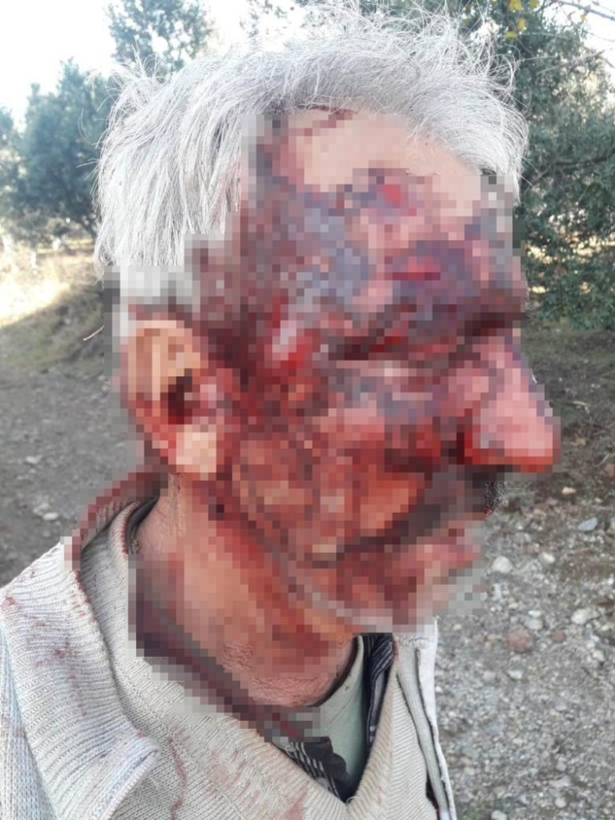 Engelli vatandaşı &ouml;ld&uuml;resiye d&ouml;v&uuml;p &ccedil;ukura attı
