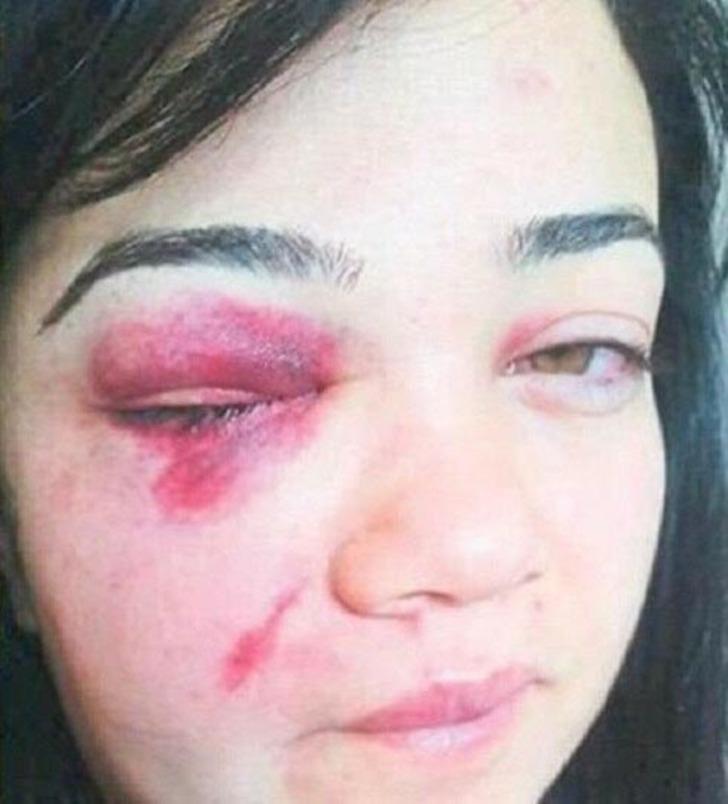 Şiddet gören Zeliha'ya oğlundan acı uyarı: Topuklu giyme, babam görürse kaçamazsın G4