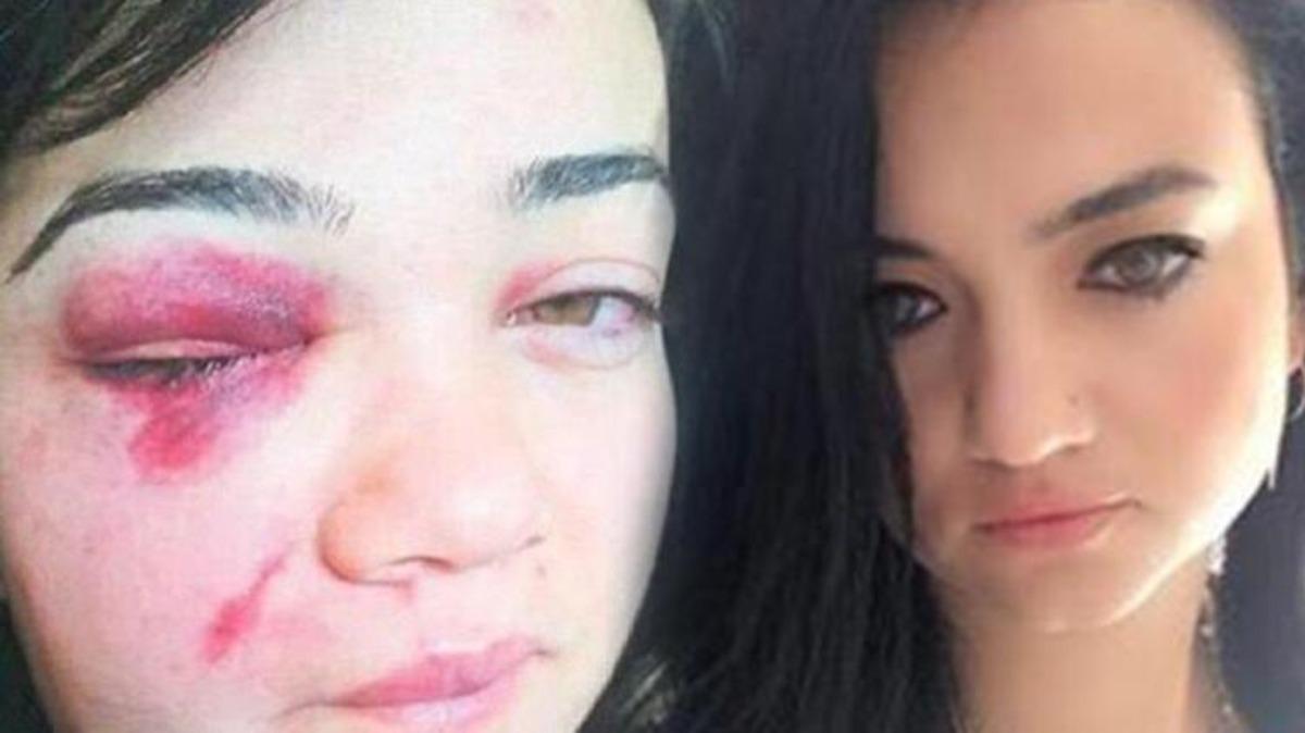 Şiddet g&ouml;ren Zeliha'ya oğlundan acı uyarı: Topuklu giyme, babam g&ouml;r&uuml;rse ka&ccedil;amazsın